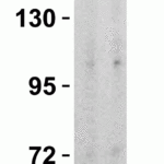 <strong>Figure 4 Overexpression Validation in Spike Transfected 293 Cells </strong><br>Loading: 10 μg per lane of Spike transfected 293 cell lysate.  Antibodies: SARS-CoV-2 (COVID-19) Spike, 9123, 1h incubation at RT in 5% NFDM/TBST.  Secondary: Goat anti-rabbit IgG HRP conjugate at 1:10000 dilution.  Lane 1: 1 μg/mL and Lane 2: 2 μg/mL