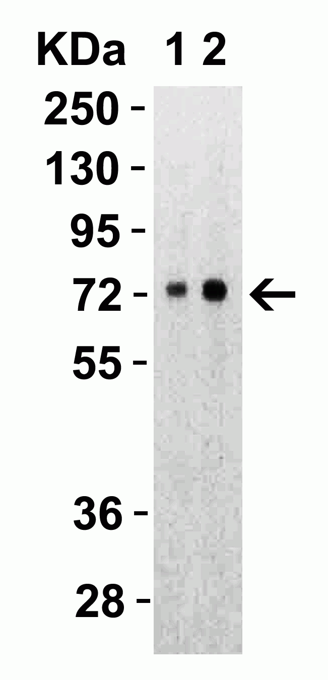 SARS-CoV-2 (COVID-19) Spike S2 Antibody