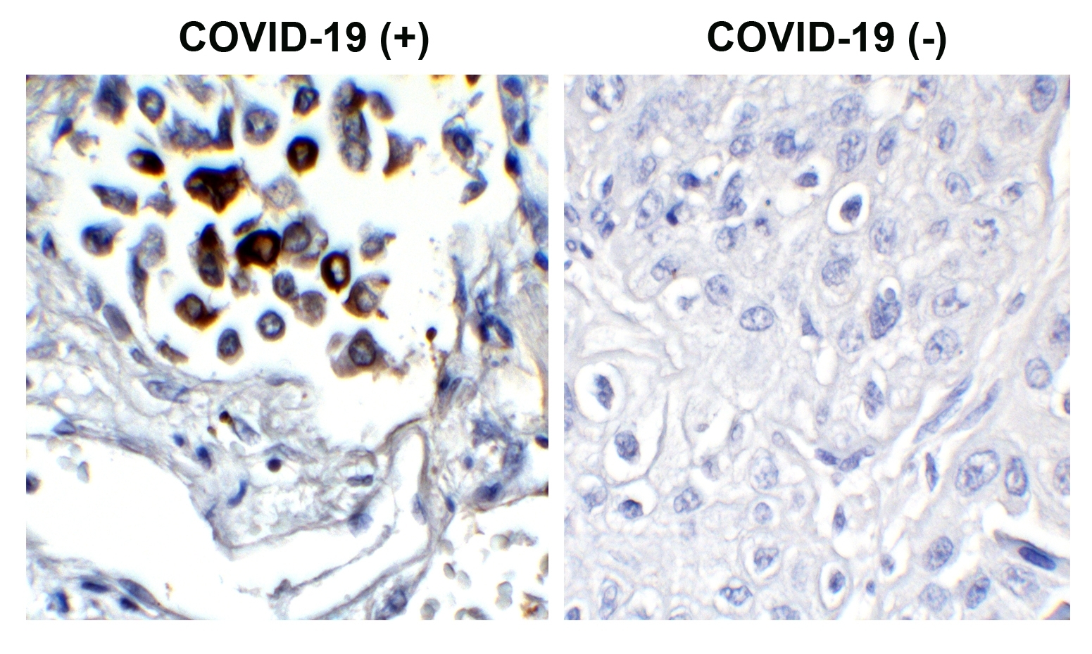 SARS-CoV-2 (COVID-19) Nucleocapsid Antibody [3865]