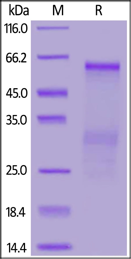 SARS-CoV-2 (COVID-19) Nucleocapsid Recombinant Protein