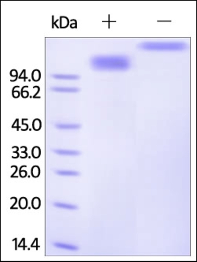SCARB1 Recombinant Protein