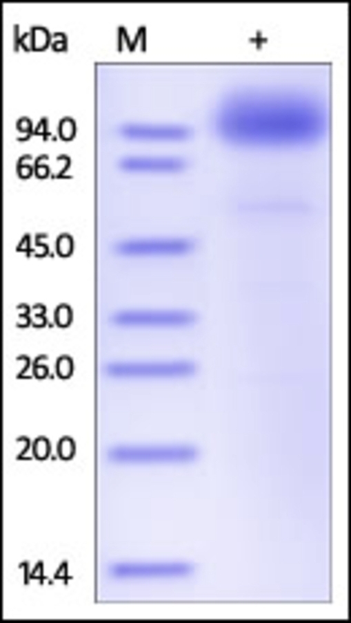 SCARB2 Recombinant Protein