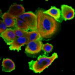 This antibody stained CACO-2 cells and A-431cells.  The primary antibody was incubated at 2.0 ug/ml overnight at 4C followed by a fluorescent labeled secondary antibody.  Optimal concentrations and conditions may vary.  Information and photo are courtesy of the Cell Profiling group, SciLifeLab Stockholm.