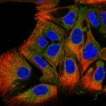 This antibody stained CACO-2 cells.  The primary antibody was incubated at 2.0 ug/ml overnight at 4°C followed by a fluorescent labeled secondary antibody.  Optimal concentrations and conditions may vary.  Information and photo are courtesy of the Cell Profiling group, SciLifeLab Stockholm.