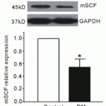 <strong>Regulation Validation of SCF in Streptozotocin (STZ)-induced Diabetic Mice (Zhang et al.,  2016) </strong><br>WB analysis showed protein expression level of SCF detected by anti-SCF antibody (5165) in gastric smooth muscle was  significantly decreased in STZ-induced diabetic mice as compared to the control.