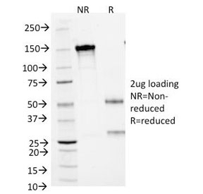 SCLC Marker Antibody [MOC-52]