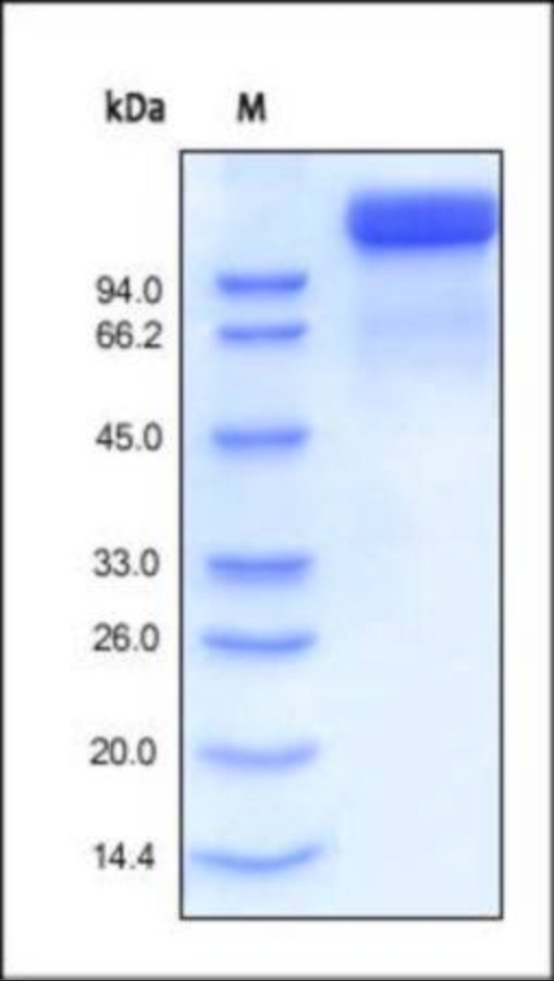 SEMA4D Recombinant Protein