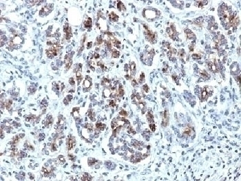 SERPINA3 Antibody [AACT/1451]