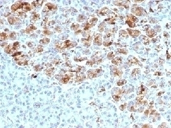 SERPINA3 Antibody [AACT/1452]