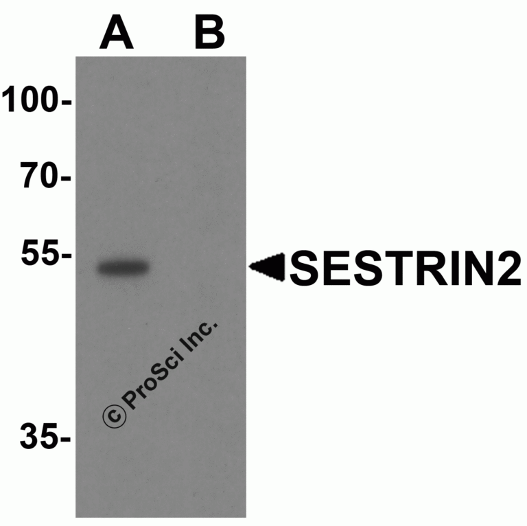 SESTRIN2 Peptide