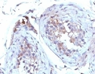 SHBG Antibody [TTEB3]