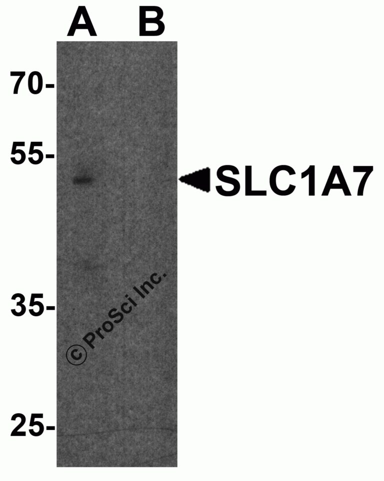 SLC1A7 Peptide
