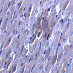Immunocytochemistry of SLC27A6 in rat heart tissue with SLC27A6 antibody at 5 μg/mL.