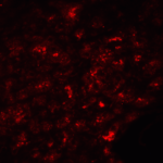 Immunofluorescence of SLC30A8 in human pancreas tissue with SLC30A8 Antibody at 20 μg/mL.
