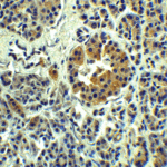 Immunohistochemistry of SLC30A8 in human pancreas tissue with SLC30A8 Antibody at 5 μg/mL.