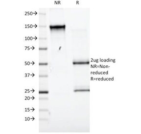 SLC3A2 Antibody [UM7F8]