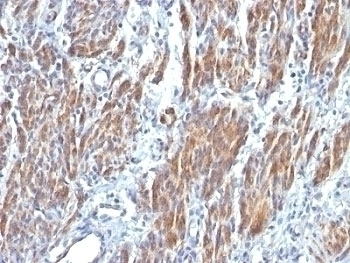 SM-MHC Antibody [SMMS-1]