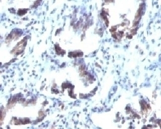SM22 alpha Antibody [SMP22a]