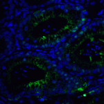 Immunofluorescence of SMARCA4 in mouse testis tissue with SMARCA4 antibody at 20 μg/ml.<br><br>Green: SMARCA4 Antibody (7749) <br> Blue: DAPI staining