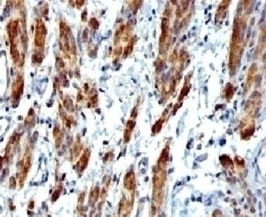 SMMHC Antibody [SMM11-1]