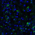 Immunofluorescence of SMURF2 in human uterus tissue with SMURF2 antibody at 20 μg/ml.<br><br>Green: SMURF2 Antibody (7773) <br> Blue: DAPI staining