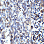 Immunohistochemistry of SMURF2 in human uterus tissue with SMURF2 antibody at 2 μg/ml.