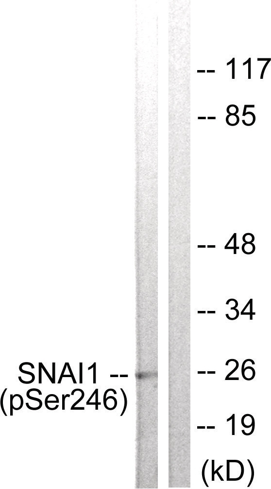 SNAI1 (phospho Ser246) Antibody