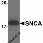 Western blot analysis of 1 ng of recombinant human SNCA with SNCA antibody at 1 μg/ml.