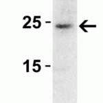 <strong>WB Validation  in Rat Pancreas</strong><br>Loading: 15 μg of cell lysate Antibodies:  SOCS1 3767,  2 μg/ml, 1 h incubation at RT in 5% NFDM/TBST.Secondary: Goat Anti-Rabbit IgG HRP conjugate at 1:10000 dilution.Exposure: 5 min