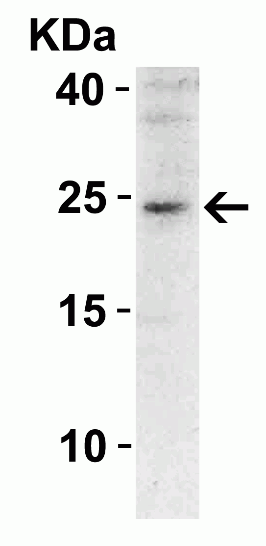 SOCS1 Antibody