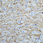 Immunohistochemistry of SOX2 in mouse brain tissue with SOX2 Antibody at 5 μg/mL.
