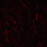 Immunofluorescence of SPIB in human prostate tissue with SPIB Antibody at 20 μg/mL.