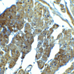 Immunohistochemistry of SPIB in human prostate tissue with SPIB antibody at 2.5 μg/ml.