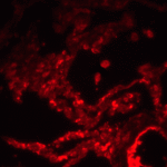 Immunofluorescence of SPINSTER in human lung tissue with SPINSTER antibody at 20 μg/ml.