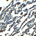 Immunohistochemistry of SPINSTER in human lung tissue with SPINSTER antibody at 2.5 μg/ml.