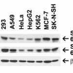 <strong>Figure 1 Independent Antibody Validation (IAV) via Protein Expression Profile in Human Cell Lines</strong><br>Loading: 15 μg of lysates per lane.Antibodies: SPT2, 6305 (1 μg/mL), SPT2, 64-238 (1 μg/mL), and beta-actin (1 μg/mL),  1h incubation at RT  in 5% NFDM/TBST.Secondary: Goat anti-rabbit IgG HRP conjugate at 1:10000 dilution.