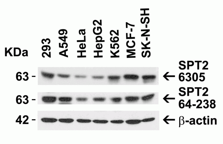 SPT2 Antibody