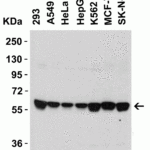 <strong>Figure 2 Western Blot Validation in Human Cell Lines</strong><br>Loading: 15 μg of lysates per lane.Antibodies: SPT2, 6305 (1 μg/mL),  1h incubation at RT  in 5% NFDM/TBST.Secondary: Goat anti-rabbit IgG HRP conjugate at 1:10000 dilution.