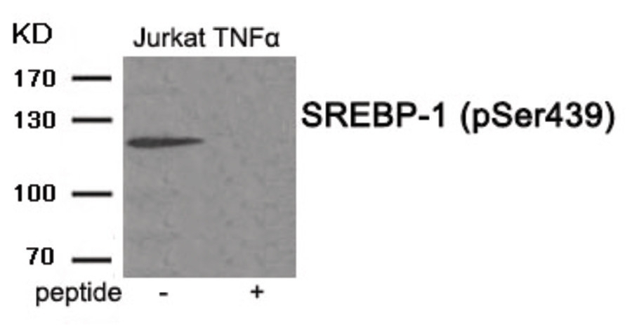 SREBP-1 (phospho Ser439) Antibody