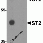 Western blot analysis of ST2 in 293 cell lysate with ST2 antibody at 1 μg/ml in (A) the absence and (B) the presence of blocking peptide.