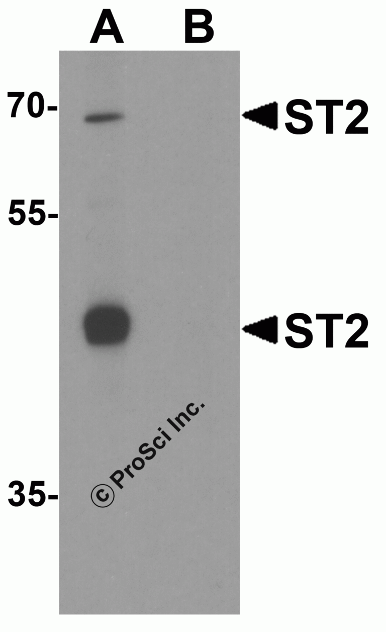 ST2 Peptide