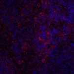 Immunofluorescence of STIM1 in Hek293 cells with STIM1 antibody at 20 μg/mL.<br><br>Red: STIM1 Antibody (4119) <br> Blue: DAPI staining