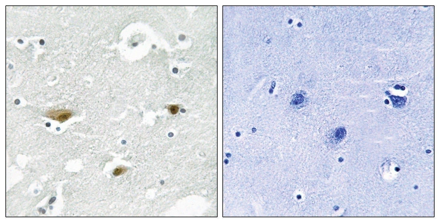 STK39 (phospho Ser325) Antibody