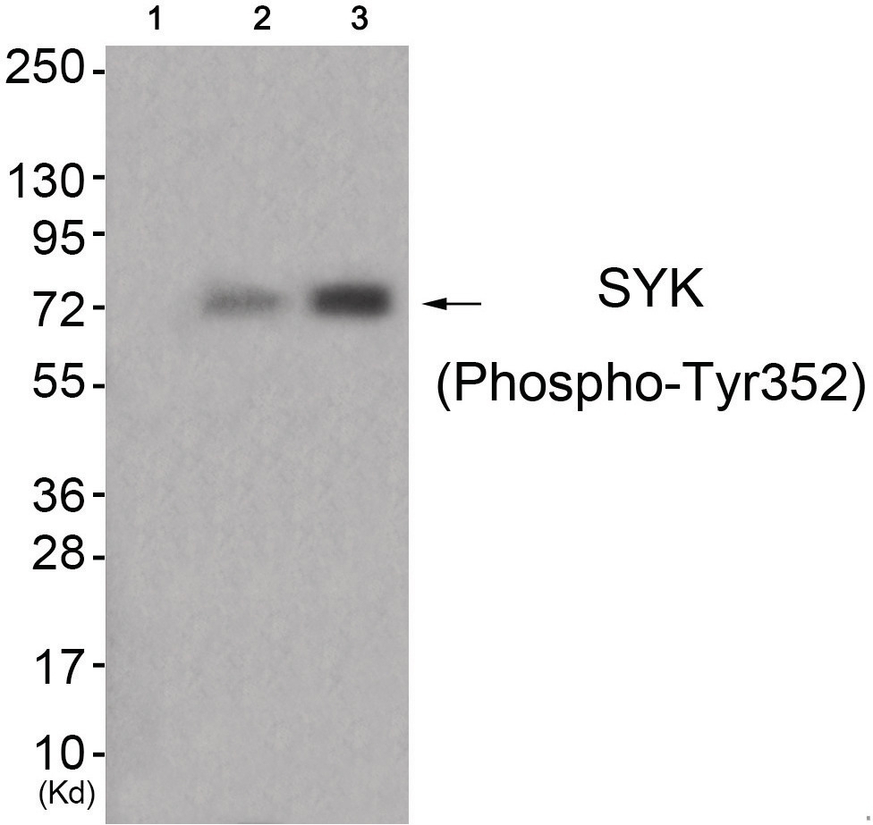 SYK (phospho Tyr352) Antibody