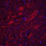 Immunofluorescence of SYNPO in mouse brain tissue with SYNPO antibody at 20 μg/mL.<br><br>Red: SYNPO Antibody (6049) <br> Blue: DAPI staining
