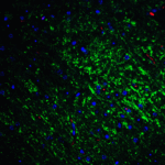 Immunofluorescence of Slitrk1 in mouse brain tissue with Slitrk1 Antibody at 20 μg/mL.<br><br>Green: Slitrk1 antibody (4455) <br> Red: Phylloidin staining<br> Blue: DAPI staining