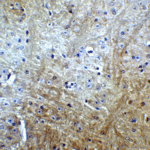 Immunohistochemistry of Slitrk1 in mouse brain tissue with Slitrk1 Antibody at 5 μg/mL.