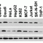 <strong>Figure 2 Independent Antibody Validation (IAV) via Protein Expression Profile in Cell Lines</strong><br>Loading: 15 μg of lysates per lane.Antibodies: Smac 2409 (1 μg/mL), Smac 2411 (1 μg/mL),  and beta-actin (1 μg/mL),  1h incubation at RT  in 5% NFDM/TBST.Secondary: Goat anti-rabbit IgG HRP conjugate at 1:10000 dilution.
