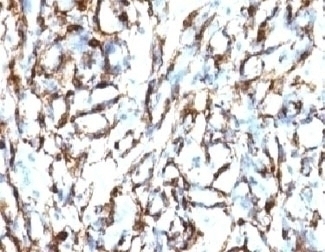 Smooth Muscle Actin Antibody [SMAT2-1]