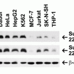 <strong>Figure 2 Independent Antibody Validation (IAV) via Protein Expression Profile in Human Cell Lines</strong><br>Loading: 15 μg of lysates per lane.Antibodies: Survivin 2233 (5 μg/mL), Survivin 2235 (4 μg/mL) and beta-actin 3779 (1 μg/mL),  1h incubation at RT  in 5% NFDM/TBST.Secondary: Goat anti-rabbit IgG HRP conjugate at 1:10000 dilution.